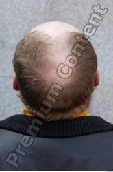 Head Hair Man White Casual Chubby Overweight Bald Street photo references